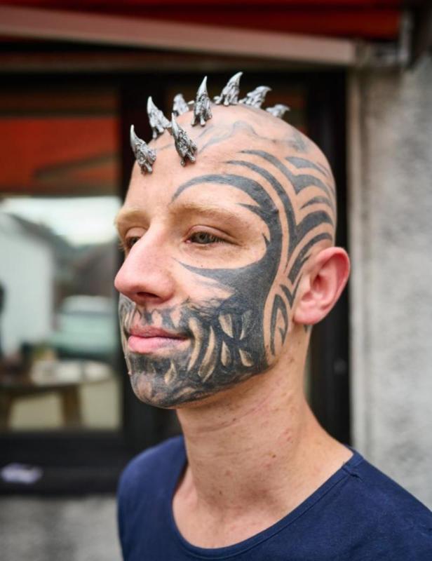 A body modification enthusiast, transforming into a ‘reptilian,’ gets silicone implants in his skull to achieve a cohesive lizard-inspired look, sparking mixed reactions.