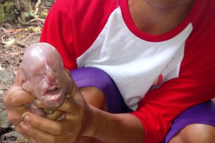 A pig in the Philippines gave birth to a ‘human-like’ piglet that cried like a baby. The rare deformity shocked locals but was linked to a birth defect.