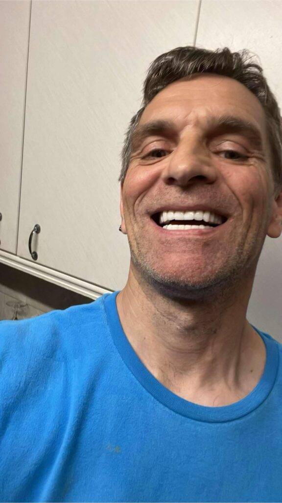 Trucker transforms with £7,000 Turkey teeth, looking 10 years younger after implants restore his smile—and his first steak in 20 years!