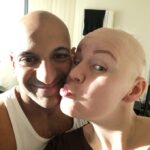 A woman who hid her hair loss for months now walks proudly with her “patchy” head held high, embracing alopecia and inspiring others with her journey.