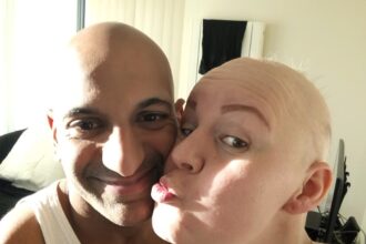 A woman who hid her hair loss for months now walks proudly with her “patchy” head held high, embracing alopecia and inspiring others with her journey.