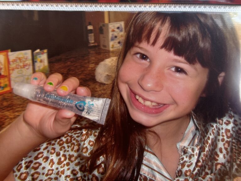 ‘I get trolled every day because of my HUGE lips people compare me to