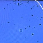 Fertility doctor goes viral after revealing how to spot 'bad' sperm under microscope - only 4 percent need to be normal for a sample to be viable.