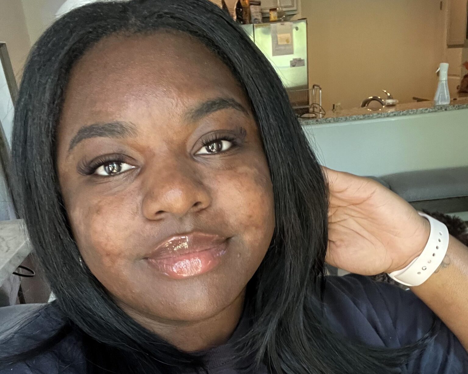 A woman lost over 6 stone using Ozempic and says it made her look 10 years younger - boosting her health, reversing pre-diabetes and transforming her confidence.