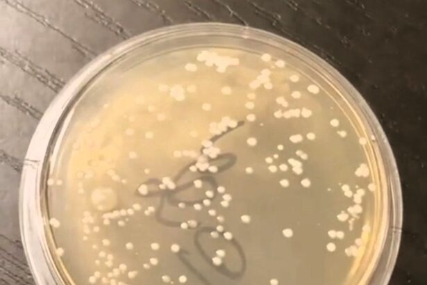 A TikTok microbiologist reveals shocking bacteria levels on swimwear hygiene stickers, urging buyers to wash before wearing as his viral test racks up millions of views.