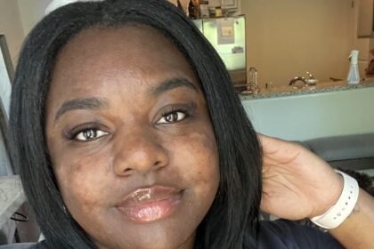 A woman lost over 6 stone using Ozempic and says it made her look 10 years younger - boosting her health, reversing pre-diabetes and transforming her confidence.