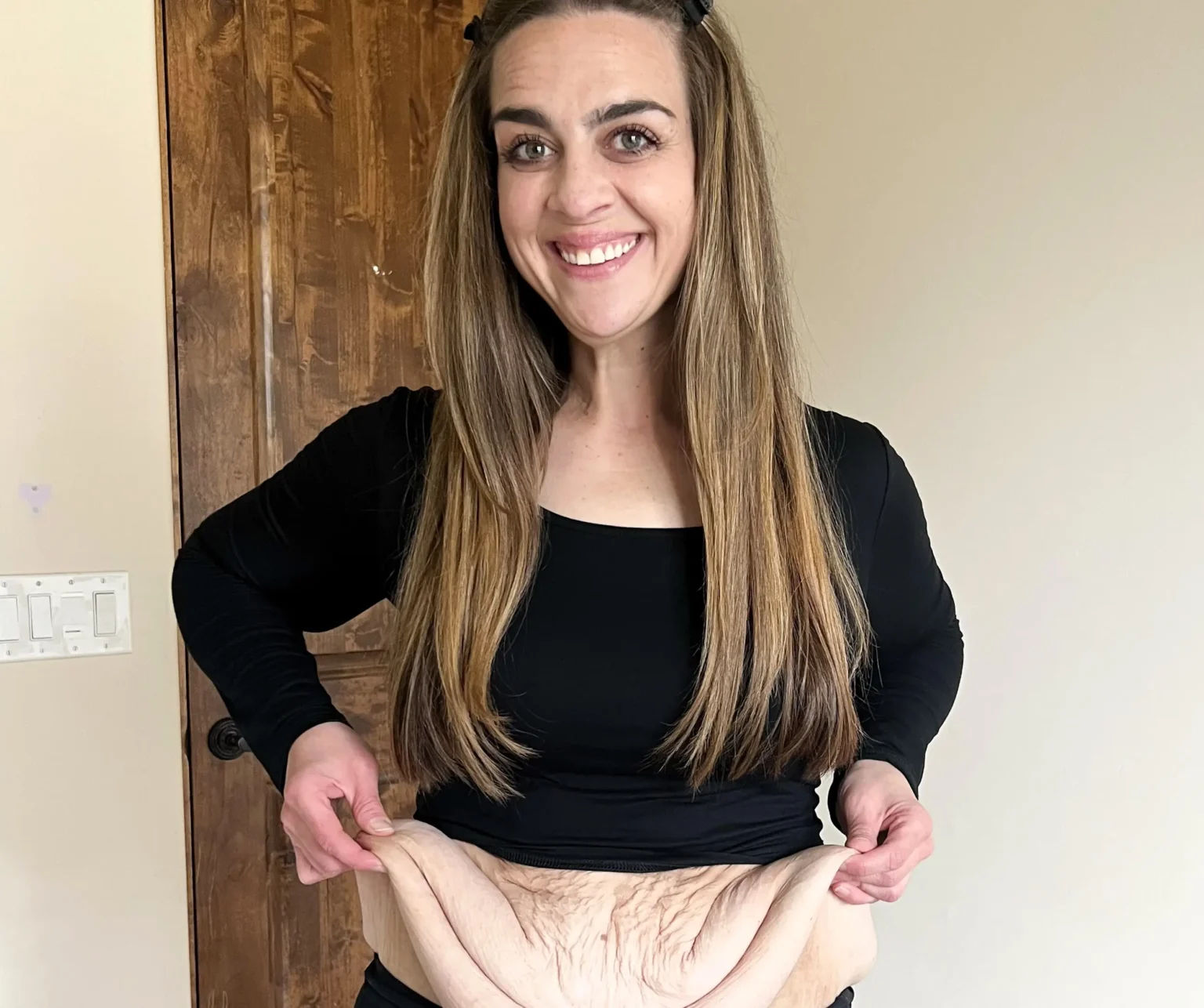 After losing 200lbs, Leah Mancuso spent $50k on skin removal surgery to match her transformation. Her emotional post-op reaction has inspired millions online.