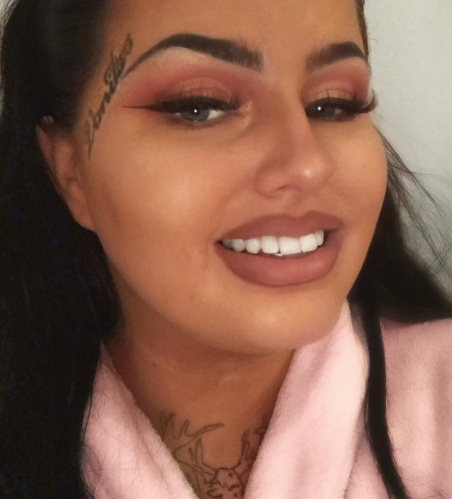A woman shocked TikTok by squeezing leaking filler from her lips, then getting a top-up despite warnings. She defends her look as part of reclaiming her true identity.