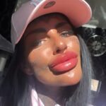 A woman shocked TikTok by squeezing leaking filler from her lips, then getting a top-up despite warnings. She defends her look as part of reclaiming her true identity.