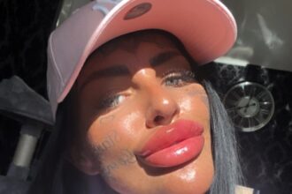 A woman shocked TikTok by squeezing leaking filler from her lips, then getting a top-up despite warnings. She defends her look as part of reclaiming her true identity.