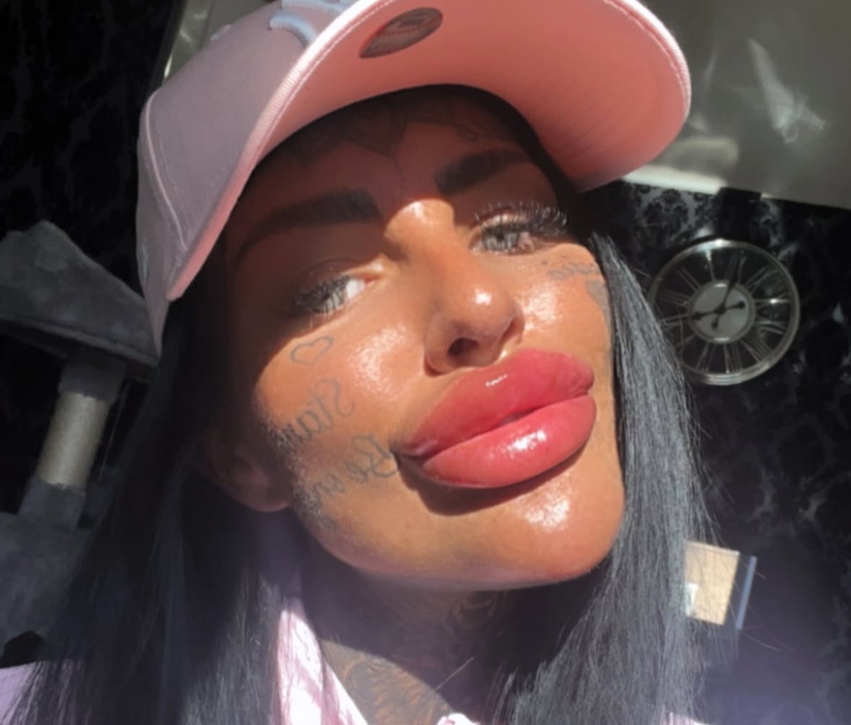 A woman shocked TikTok by squeezing leaking filler from her lips, then getting a top-up despite warnings. She defends her look as part of reclaiming her true identity.