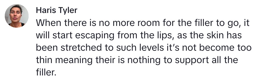 Social media comment on the post of A woman shocked TikTok by squeezing leaking filler from her lips, then getting a top-up despite warnings. She defends her look as part of reclaiming her true identity.