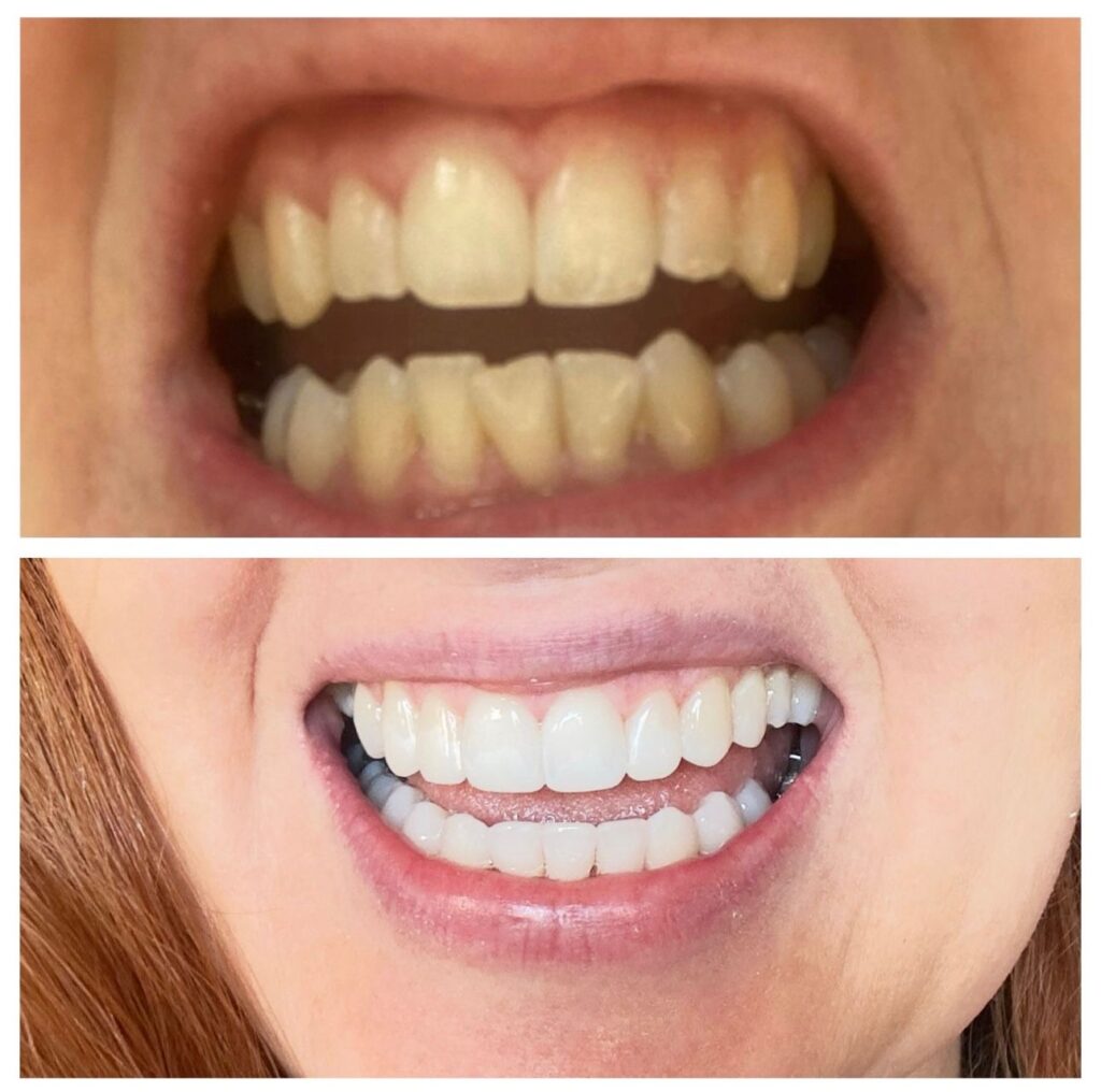 Elle Kay transformed her life with hypnotherapy, shedding nearly two stone, overcoming dental fears, and finding love after years of anxiety, stress, and low self-esteem.