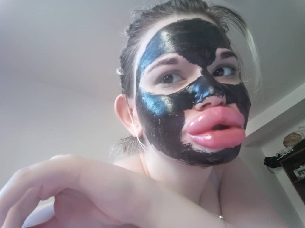Woman with ‘world’s biggest lips’ says parents call her ugly and fear for her health as she vows to keep getting fillers despite family rift and medical professionals refusing treatment.