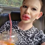 Woman with ‘world’s biggest lips’ says parents call her ugly and fear for her health as she vows to keep getting fillers despite family rift and medical professionals refusing treatment.