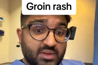 A doctor warns summer heat boosts painful groin rashes like intertrigo from tight underwear - switch to breathable cotton to avoid infection and discomfort.