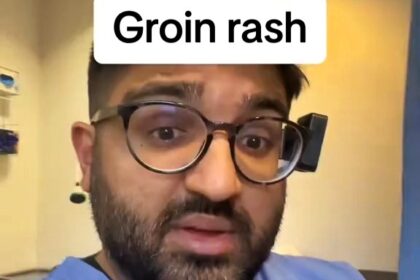 A doctor warns summer heat boosts painful groin rashes like intertrigo from tight underwear - switch to breathable cotton to avoid infection and discomfort.