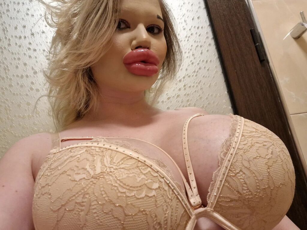 Woman with ‘world’s biggest lips’ says parents call her ugly and fear for her health as she vows to keep getting fillers despite family rift and medical professionals refusing treatment.