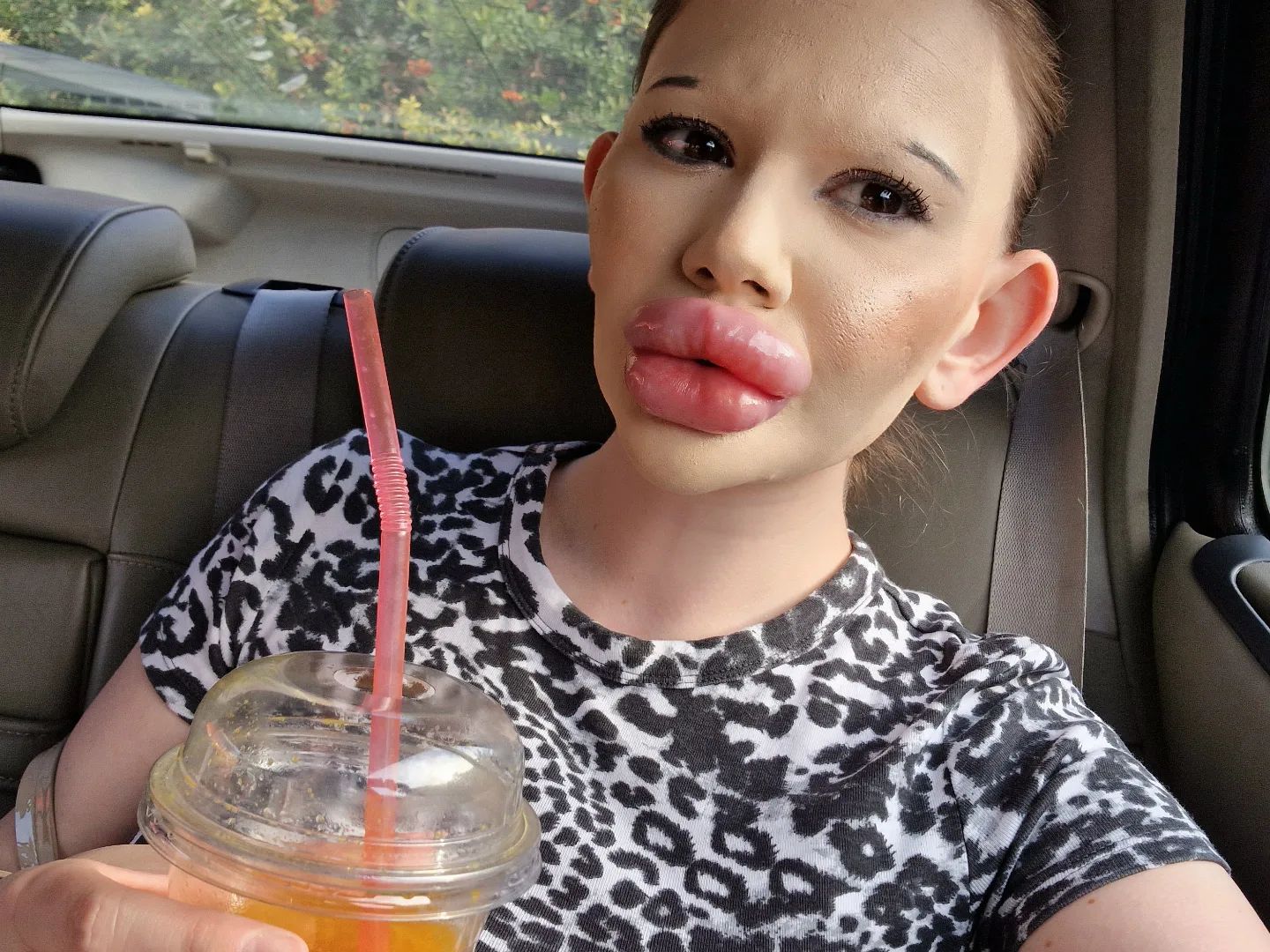 Woman with ‘world’s biggest lips’ says parents call her ugly and fear for her health as she vows to keep getting fillers despite family rift and medical professionals refusing treatment.