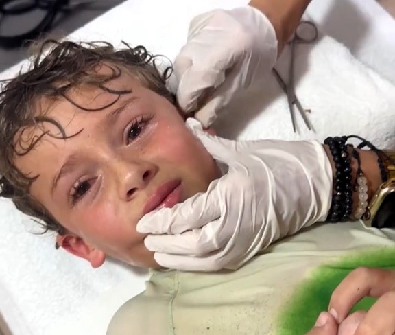 Boy has crab pulled from his ear after beach trip in Mexico - influencer mum Kitzia Mitre films viral TikTok as doctors safely remove live crustacean from son Pedro.