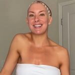 Bride to be dancer Caroline Miele turned to TikTok for help after her shoulder mysteriously rose higher than the other with physical therapy now giving her hope before her wedding.