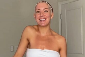 Bride to be dancer Caroline Miele turned to TikTok for help after her shoulder mysteriously rose higher than the other with physical therapy now giving her hope before her wedding.