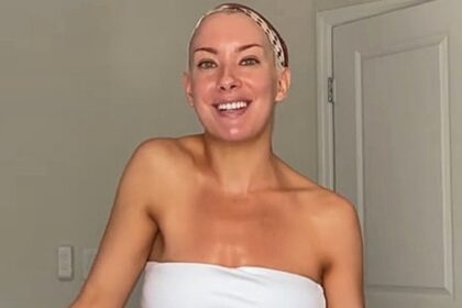 Bride to be dancer Caroline Miele turned to TikTok for help after her shoulder mysteriously rose higher than the other with physical therapy now giving her hope before her wedding.