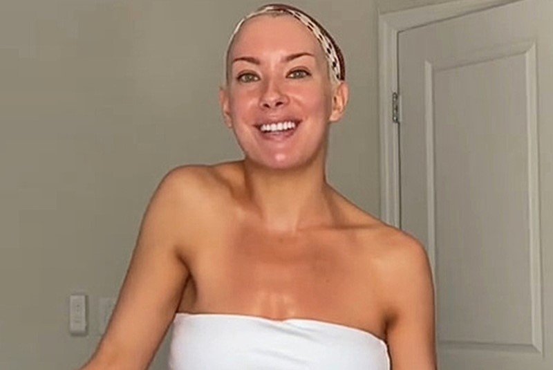 Bride to be dancer Caroline Miele turned to TikTok for help after her shoulder mysteriously rose higher than the other with physical therapy now giving her hope before her wedding.