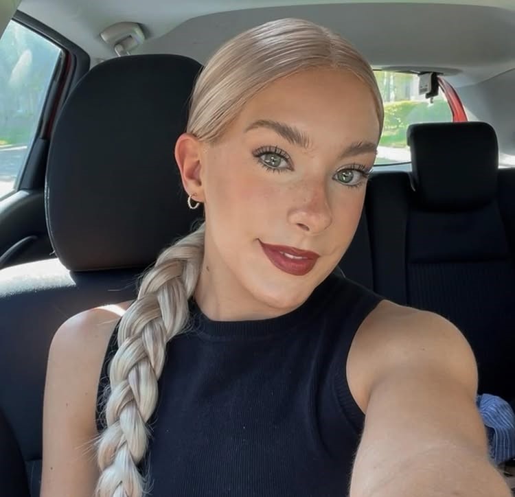 Bride to be dancer Caroline Miele turned to TikTok for help after her shoulder mysteriously rose higher than the other with physical therapy now giving her hope before her wedding.