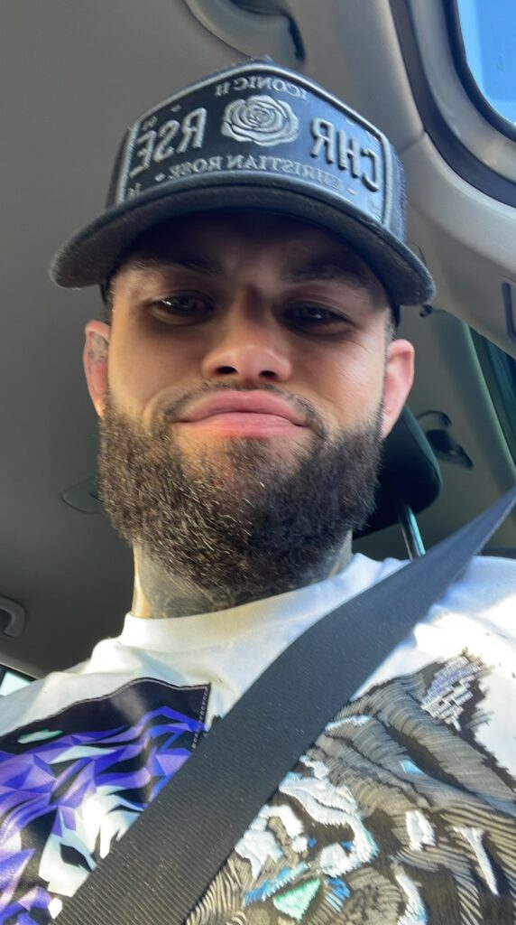 A man who flew to Turkey for a £2000 beard transplant says it was the best decision of his life after years of patchy growth left him insecure and struggling with confidence.