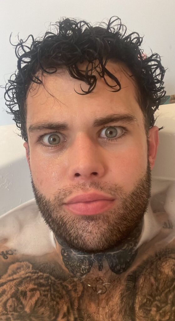 A man who flew to Turkey for a £2000 beard transplant says it was the best decision of his life after years of patchy growth left him insecure and struggling with confidence.