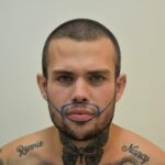 A man who flew to Turkey for a £2000 beard transplant says it was the best decision of his life after years of patchy growth left him insecure and struggling with confidence.