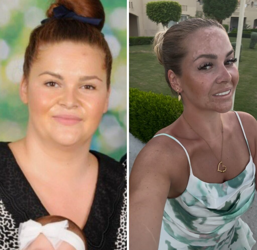 Mum-of-two Abbie Lodge dropped four stone in four months by making one daily change to her lifestyle - proving simple swaps can spark lasting weight loss success.