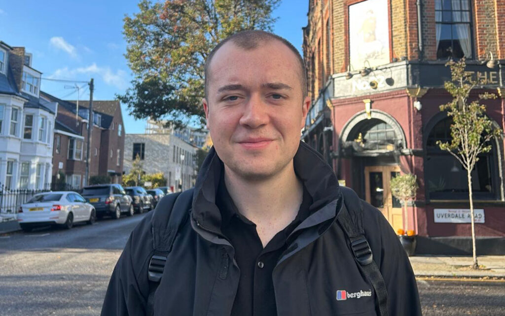 A man joked he looked like Megamind after severe swelling from a £3,500 hair transplant left his forehead ballooned and eyes bruised while he waited for long term results.