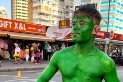 the Lad who turns himself bright green for days after using textile paint to dress as the Hulk in Benidorm