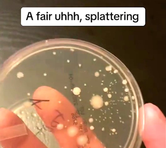 Nick testing his own flatulence for bacteria.