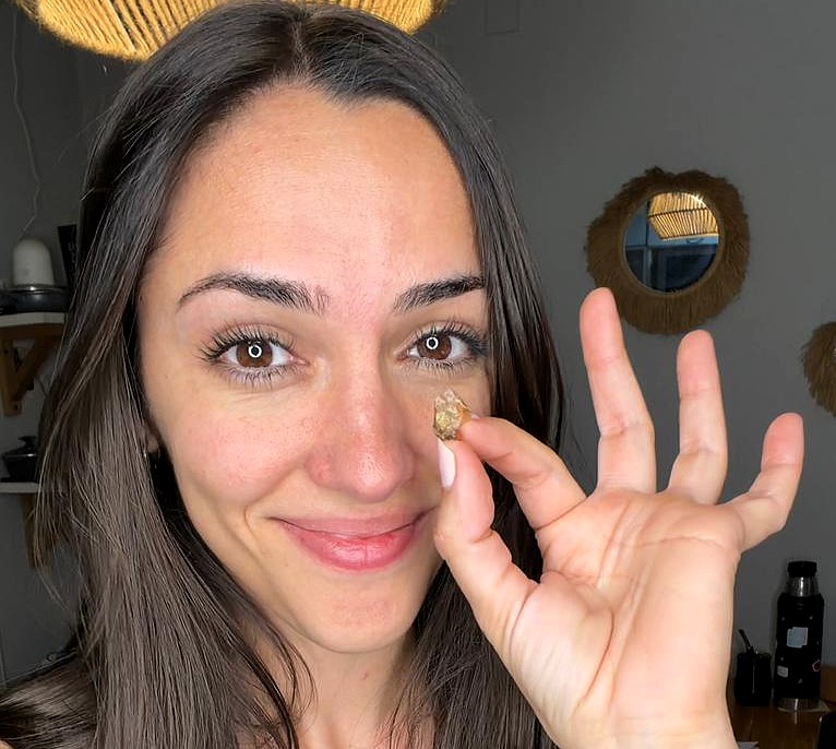 Argentine mum Candela Reybaud discovers a ball of sticky tape lodged in her nose for 35 years after lifelong breathing issues leading to its removal and an instant dramatic improvement.