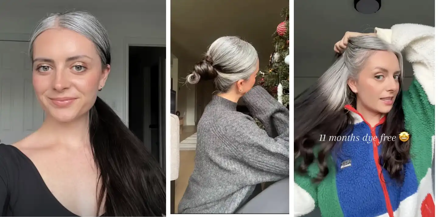 A woman who went fully grey in her teens is finally embracing her natural silver hair after years of bullying, inspiring millions with her dye free journey and message of self love.