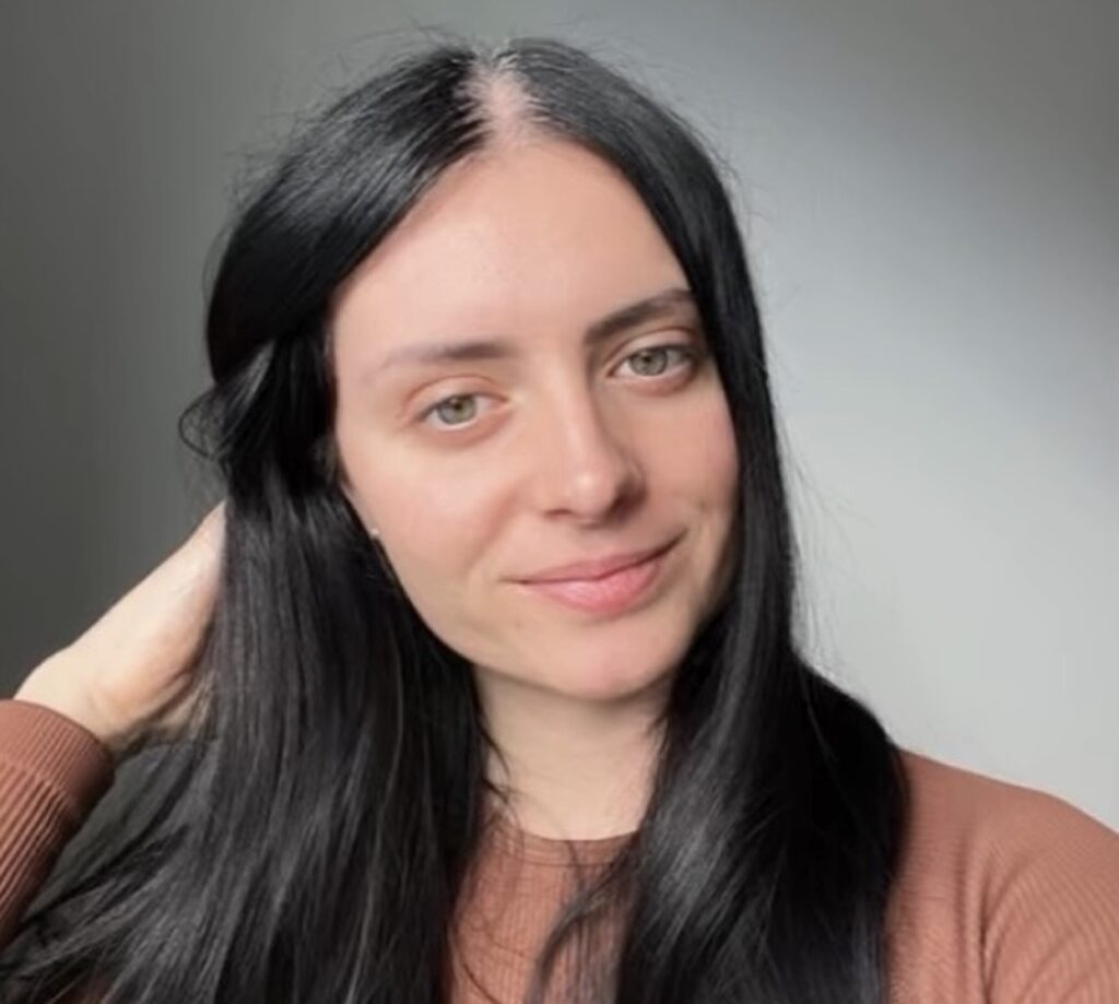 A woman who went fully grey in her teens is finally embracing her natural silver hair after years of bullying, inspiring millions with her dye free journey and message of self love.