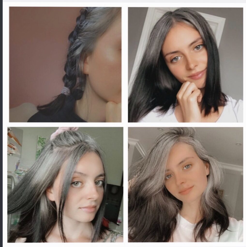 A woman who went fully grey in her teens is finally embracing her natural silver hair after years of bullying, inspiring millions with her dye free journey and message of self love.