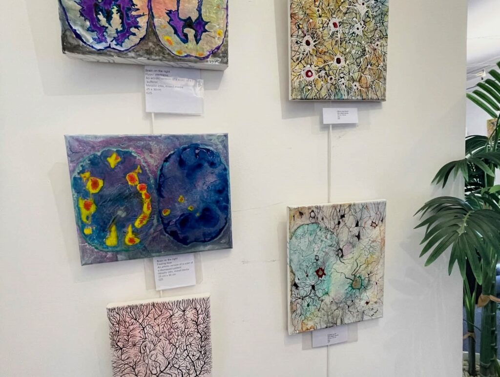 Cancer survivor transforms brain scans into colourful paintings turning illness into art as patient stories become emotional tributes celebrating healing resilience and the NHS.
