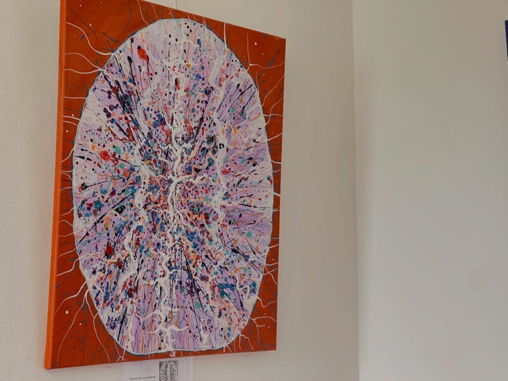 Cancer survivor transforms brain scans into colourful paintings turning illness into art as patient stories become emotional tributes celebrating healing resilience and the NHS.