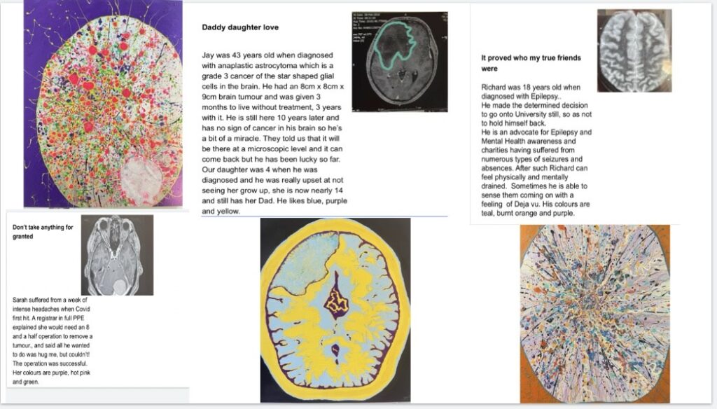 Cancer survivor transforms brain scans into colourful paintings turning illness into art as patient stories become emotional tributes celebrating healing resilience and the NHS.