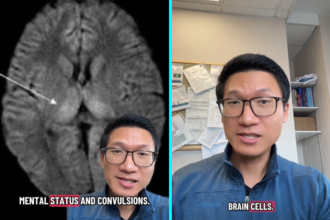 Neurologist Dr Bing warns leftover rice at room temperature can cause fried rice syndrome from bacillus cereus toxin that attacks brain cells, particularly dangerous for children despite being rare.