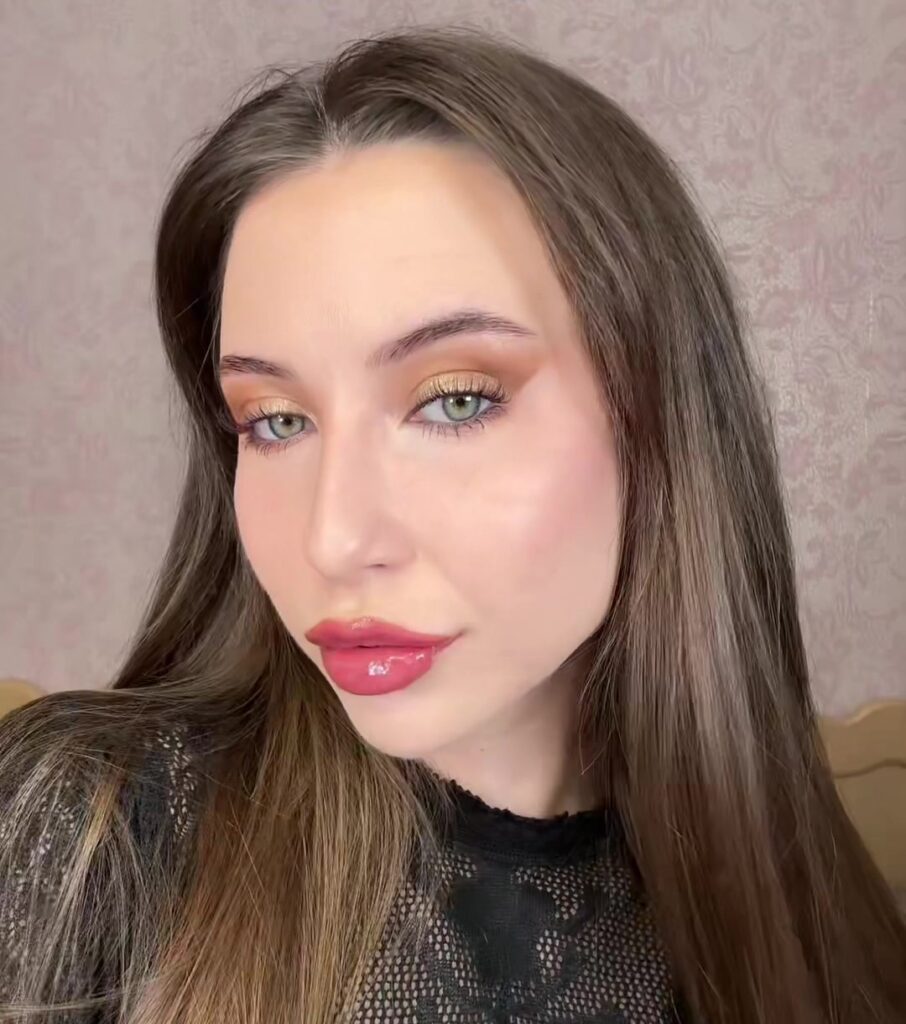 Woman left shocked after clinic taped up her lips following filler procedure. Kseniia Krainia's practitioner used new technique designed to hold filler in correct position.