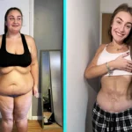 Elliemay Sherwin weighed 25 stone and was told she'd never have children. After gastric bypass, she lost 14 stone and reversed ovarian damage - now ready to start a family.