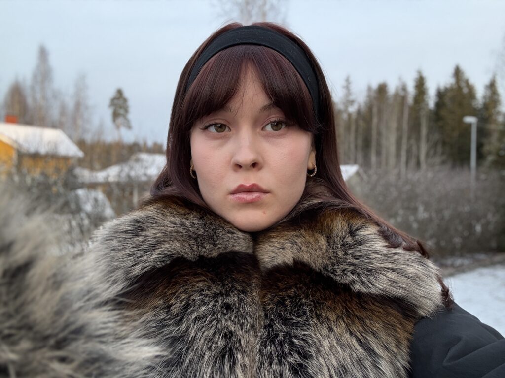 Student Annika Tammi, 25, cured her lifelong eczema by cutting out sugar, wheat and ultra-processed foods after discovering her skin problems stemmed from gut imbalance issues.