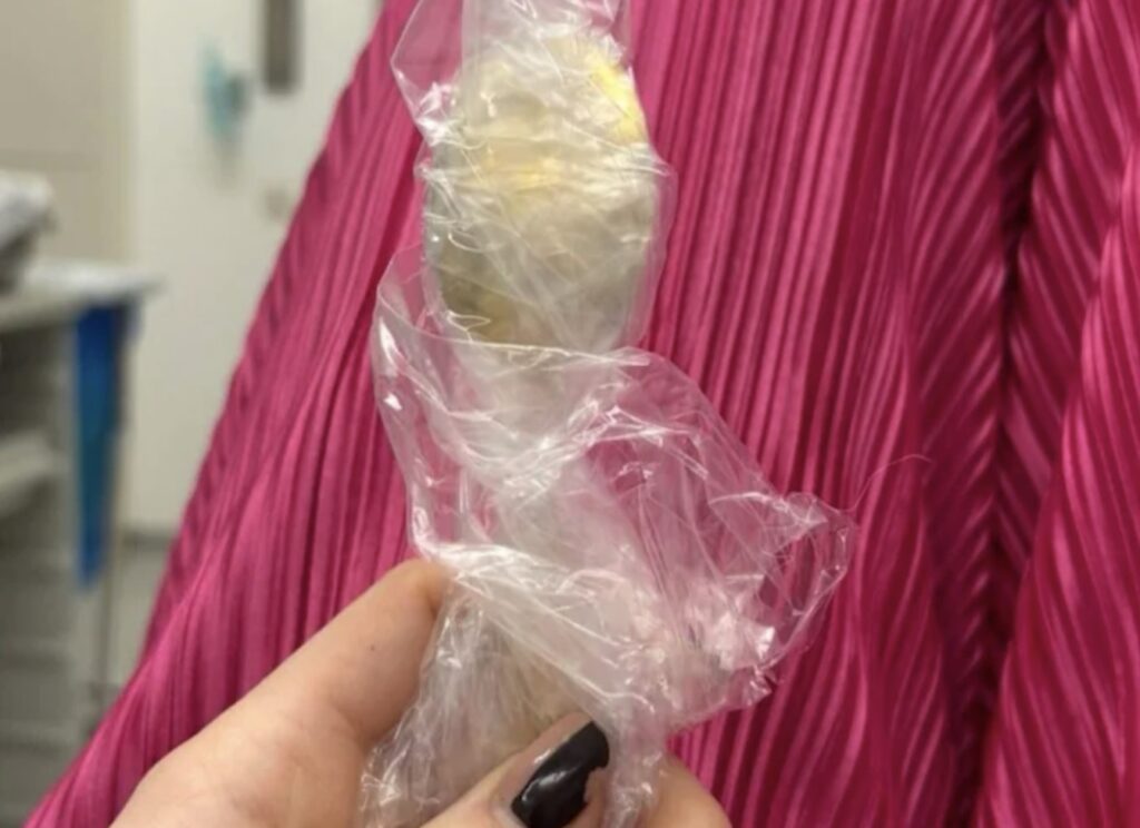 Reymy Amelinckx from Rumst, Belgium swallowed 17cm spoon when her Hungarian Vizsla Marley jumped on her lap while eating yogurt. Spoon removed via gastroscopy.