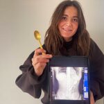 Reymy Amelinckx from Rumst, Belgium swallowed 17cm spoon when her Hungarian Vizsla Marley jumped on her lap while eating yogurt. Spoon removed via gastroscopy.