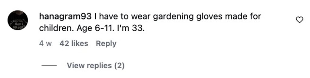 Social media comment on the post of Woman, 30, with child-sized hands goes viral after revealing she can't hold pint glasses or carry rounds. She buys kids' gloves and struggles with jars and large items.